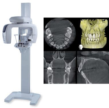 歯科用CTとは？